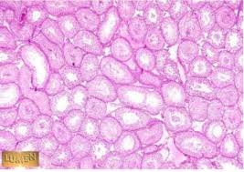 Check spelling or type a new query. Male Reproductive Histology Slides Flashcards Quizlet