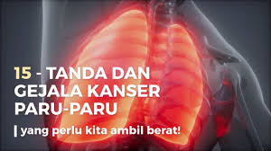 Di tahap membimbangkan 14 nov 2015. 15 Tanda Dan Gejala Kanser Paru Paru Yang Perlu Kita Ambil Berat