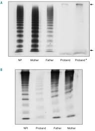 A vfd is the better choice if speed control is required. Cryptic Non Canonical Splice Site Activation Is Part Of The Mechanism That Abolishes Multimer Organization In The C 2269 2270del Von Willebrand Factor Haematologica