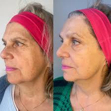 Dra. Isabel Valencia (@dra.isabelvalencia) • Instagram photos and videos