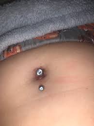 Hi My Belly Button Piercing Looks Like Shit Should I Take It Out What Should I Do There Is A Chunk Of Skin Growing On It Piercing