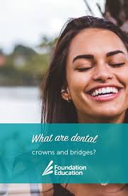 Dental Crowns And Dental Bridges Dental Crowns Dental Dental Bridge