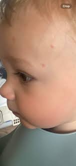 I have already written a post don't know where it's gone As you can see my  poor foxy boy is covered in open sores with flies