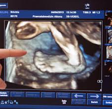 Lebenstag ihres babys, beginnt das herz zu schlagen. Ultraschall Baby Fehlbildungen Mit Sonografie Fruher Erkennen Welt