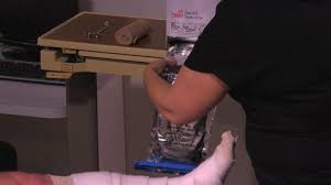 Ensuring adequate pain relief is. Overview Of Sprains And Other Soft Tissue Injuries Injuries Poisoning Msd Manual Professional Edition