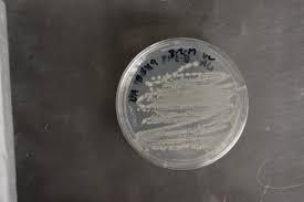 Image result for Ophrestia