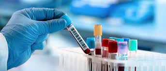 Jun 30, 2021 · sağlık bakanlığı, korona virüs tedbirleri kapsamında türkiye'ye girişlerde riskli olarak değerlendirilen ülkelere yönelik örnekleme temelinde pcr testi uygulamasının kapsamını genişletti. Koronavirus Covid 19 Testi Cesitleri Pcr Antikor Vs Tetra Lab