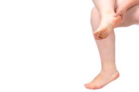 There are lots of different reasons that diabetes causes hair loss, which i will cover later in this article. Diabetes 12 Warning Signs That Appear On Your Skin