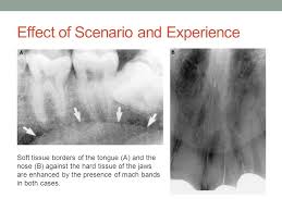 Mach Bands Effect Of Scenario And Experience On Interpretation Of Mach Bands Ppt Download