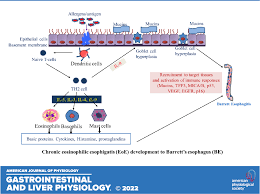 Molecules involved in the development of Barrett's esophagus phenotype in  chronic eosinophilic esophagitis