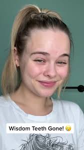 Averi White Shares Her Wisdom Teeth Removal Experience