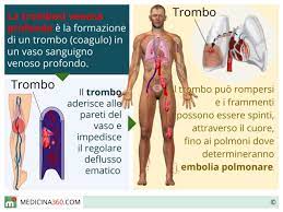 Embolia polmonare o tromboembolia polmonare. Trombosi Venosa Profonda O Superficiale Sintomi Terapia Rischi E Cause