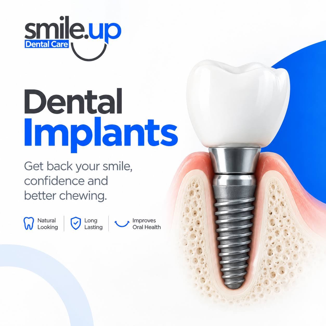 Dental Implants product image