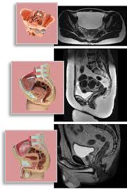 Functional anatomy of the male pelvic floor online course: Module 5 Pelvis Imaging