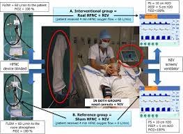 And circulatory supports are of much helpful to those the most serious cases of corona virus pneumonia. Figure 1 Apnoeic Oxygenation Via High Flow Nasal Cannula Oxygen Combined With Non Invasive Ventilation Preoxygenation For Intubation In Hypoxaemic Patients In The Intensive Care Unit The Single Centre Blinded Randomised Controlled Optiniv Trial