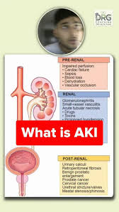Image result for Postrenal Failure