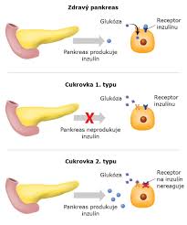 Image result for cukrovka hodnoty tabulka