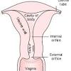 Signs of advanced cervical cancer may include pelvic pain, problems peeing, and swollen legs. 1