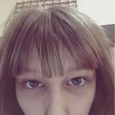 Guys My Eyes Sometimes Get Itchy From My Dogs I M A Little Allergic And I Have Eye Drops For It And Only One Eye Was Bothe Grace Vanderwaal Celebrities Grace