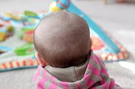Collagen may prevent hair thinning by maintaining a healthy dermis (image: How To Prevent A Bald Spot From Developing On The Back Of A Baby S Head Baby Hair Loss Baby Losing Hair Baby Hair Falling Out