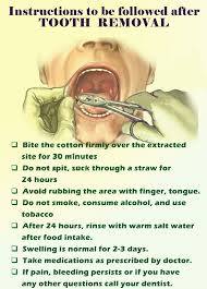 Image result for Post-Tooth Extraction Bleeding