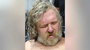 West Virginia woman wakes up from 2-year coma after being attacked; brother  arrested