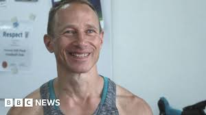 Accident left prosthetic expert in need of new arm