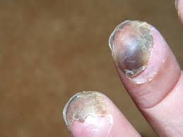 We provide the tech behind games like battlefield & mass effect. Use These Pictures To Identify Frostbite