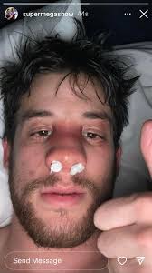 I really hope Ryan will have an okay recovery, jfc!! : r/SuperMegaShow