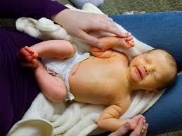 Image result for Kernicterus