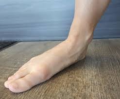 We did not find results for: Posterior Tibial Tendon Dysfunction Pttd On The Ball Orthotics Barrie