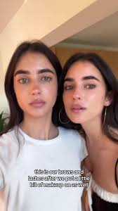 Herbert Twins Before and After