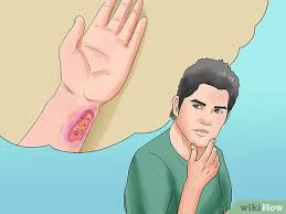 Lebensmittel, die selbst eingemacht oder. Botulismus Vorbeugen Mit Bildern Wikihow
