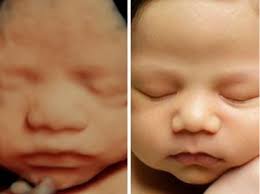 3d 4d Ultrasound With Hd Live Unborn Baby Baby Ultrasound Ultrasound