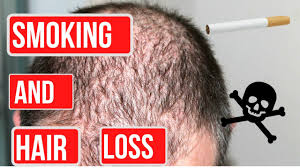 Can itchy scalp cause hair loss? Does Smoking Cause Hair Loss It Really Works Vitamins