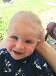 Baby Born With Brain Outside Skull Defies Odds After Parents Back Out of  Abortion