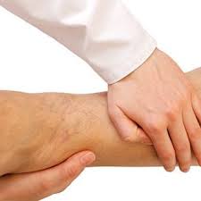 Hey andre der har oplevet at have fået væskeophobninger i kroppen generelt efter op? Haevedeben Instagram Posts Photos And Videos Picuki Com