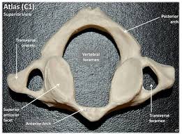 It is named for atlas of greek mythology because, just as atlas supported the globe, it supports the entire head. Atlas C1 Vertebra Superior View With Labels Axial Skeleton Visual Atlas Page 47 Anatomy And Physiology Chiropractic Care Axial Skeleton