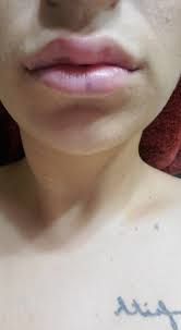 Ledbetter and his team provide a comprehensive range of cosmetic services … L Aesthetics Longevity From 179 Groupon