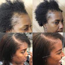 Having Trouble With Your Edges Here Are Some Tips To Help You Regrow Your Edges Like I Helped My Client Natural Hair Styles Hair Growth Treatment Regrow Hair