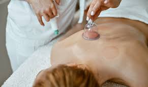 Image result for Acupuncture