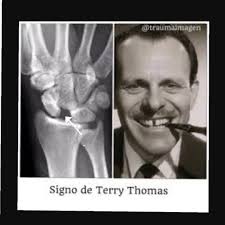 Conoces el signo de TERRY
