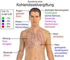 Kopfschmerzen, schwindel, übelkeit, erbrechen rosafärbung der haut trotz sauerstoffmangel, bedingt durch die hellrote farbe der verbindung aus hämoglobin und kohlenmonoxid (hbco) Kohlenstoffdioxid Wikipedia