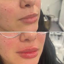 Julie Jackson McDonald (@the_wellnesswitch_cnm) • Instagram photos and  videos