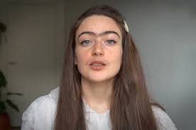 Movies tagged as 'girl with facial hair' by the listal community. Woman With Facial Hair Challenges Ideals Of Beauty I Woke Up One Day And My Face Had Gone Viral W24
