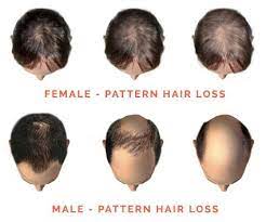 Use deep conditioning treatments to help bring back its luster, and be healthy from the inside out to promote the growth of new healthy hair. How To Restore Hair Growth And Prevent Hair Loss Without Surgery Kimi Naturals