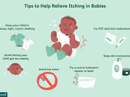 Bed bug bites are one of the reasons that these pests can be a nuisance. Anti Itch Creams And Remedies For Babies And Children