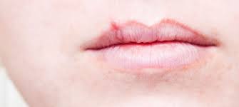 cold sore tips and treatments beautypedia