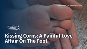 Image result for Corns