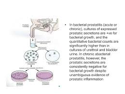 Image result for Expressed Prostatic Secretion